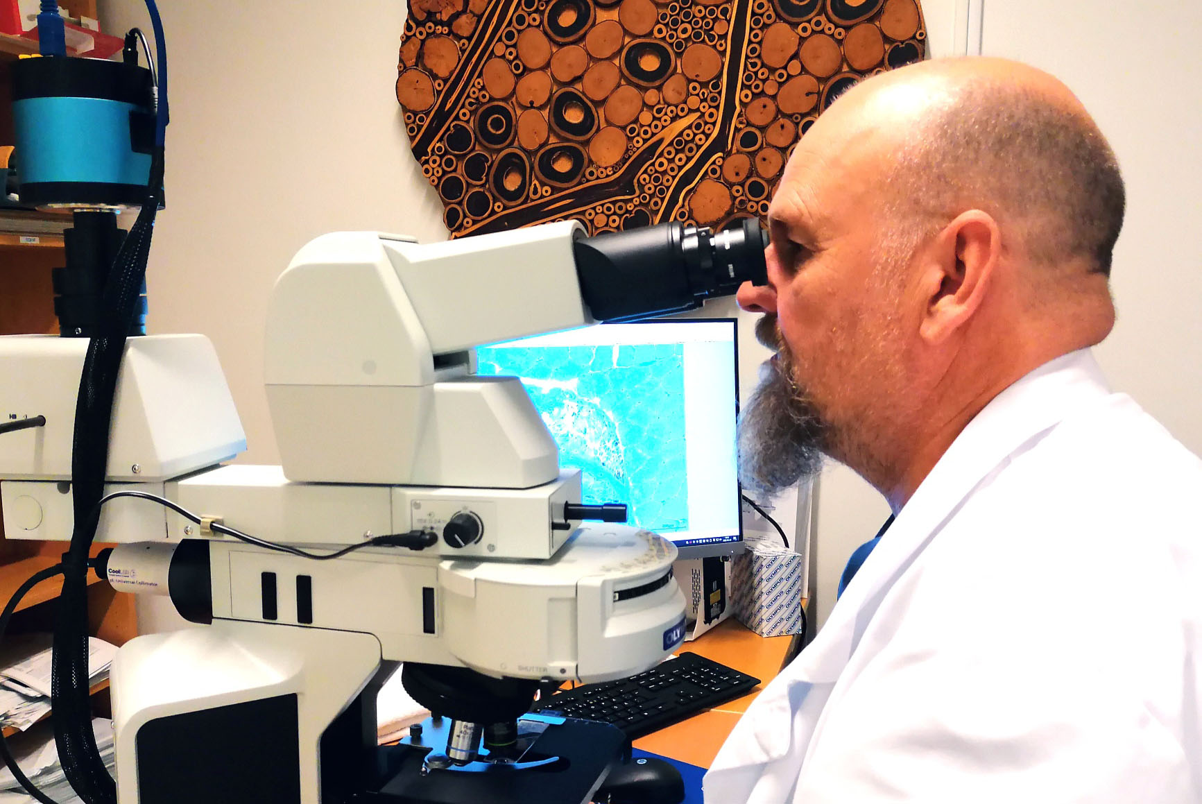 Biomedicinsk analytiker analyserar muskelbiopsi i mikroskop